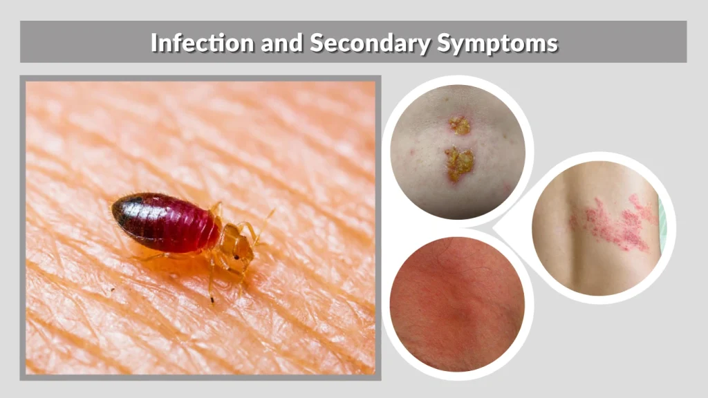 Infection and Secondary Symptoms