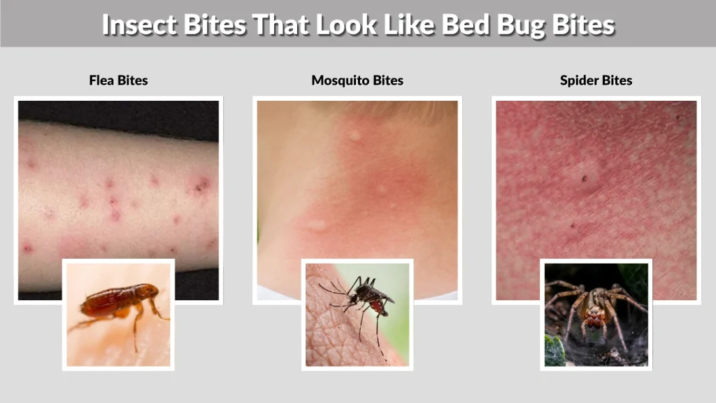 Insect Bites That Look Like Bed Bug Bites