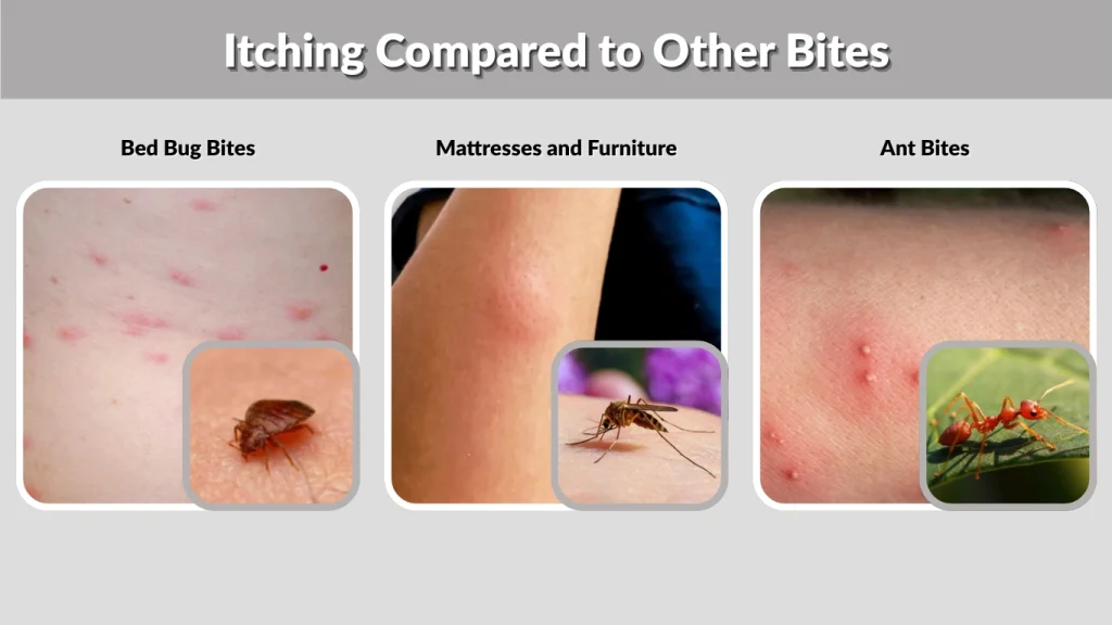 Itching Compared to Other Bites