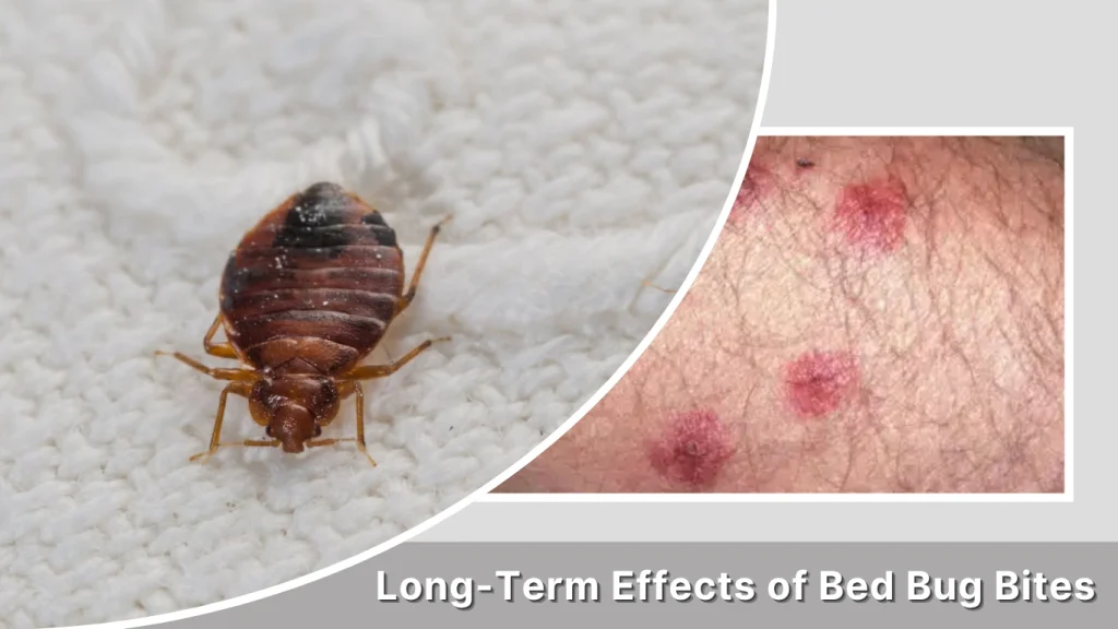 Long-Term Effects of Bed Bug Bites