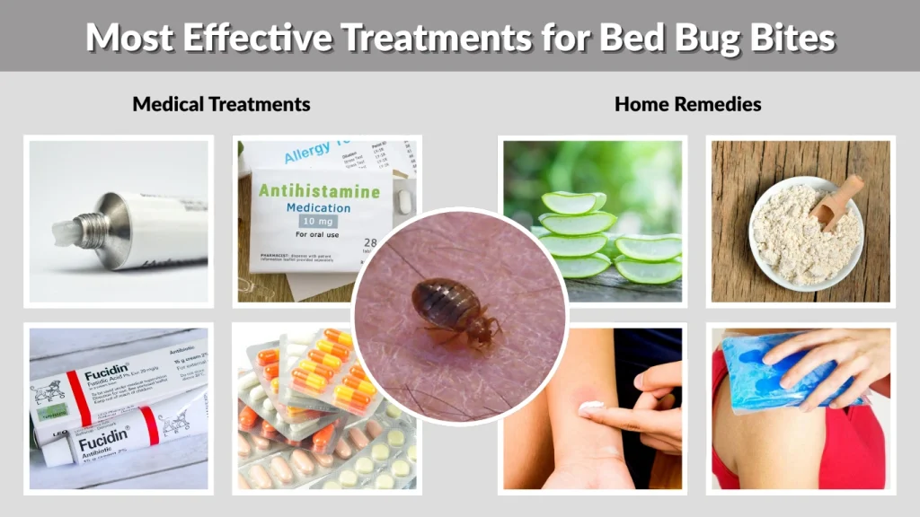 Most Effective Treatments for Bed Bug Bites