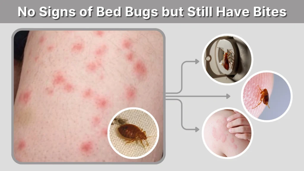 No Signs of Bed Bugs but Still Have Bites