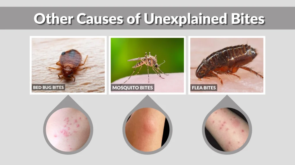 Other Causes of Unexplained Bites