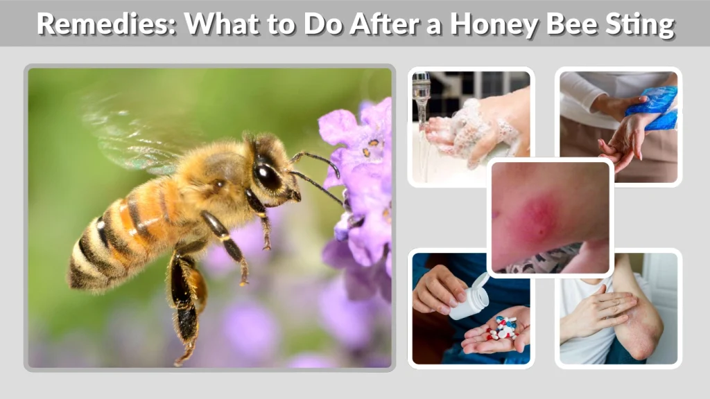 Remedies What to Do After a Honey Bee Sting