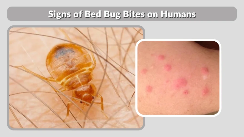 Signs of Bed Bug Bites on Humans