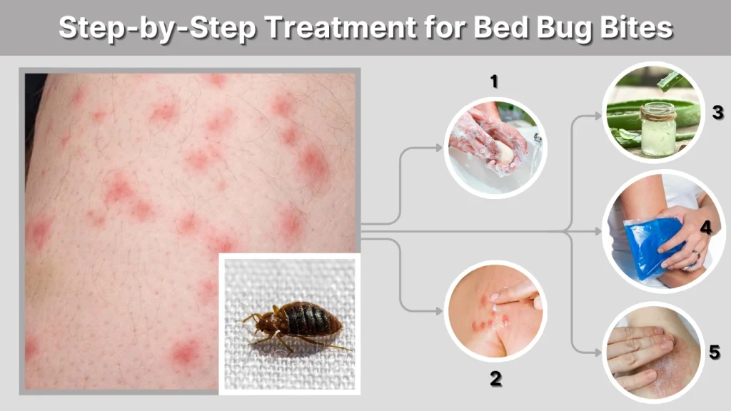 Step-by-Step Treatment for Bed Bug Bites