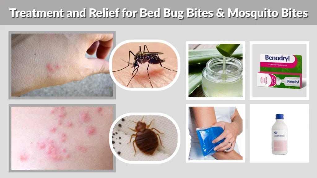 Treatment and Relief for Bed Bug Bites & Mosquito Bites
