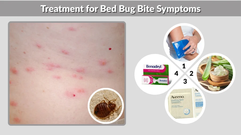 Treatment for Bed Bug Bite Symptoms