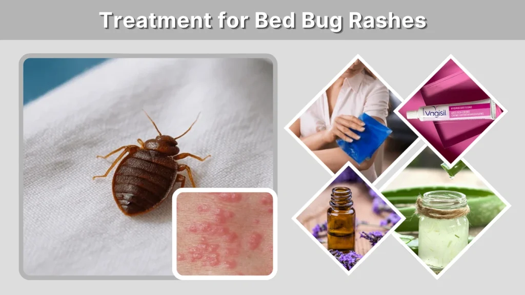 Treatment for Bed Bug Rashes