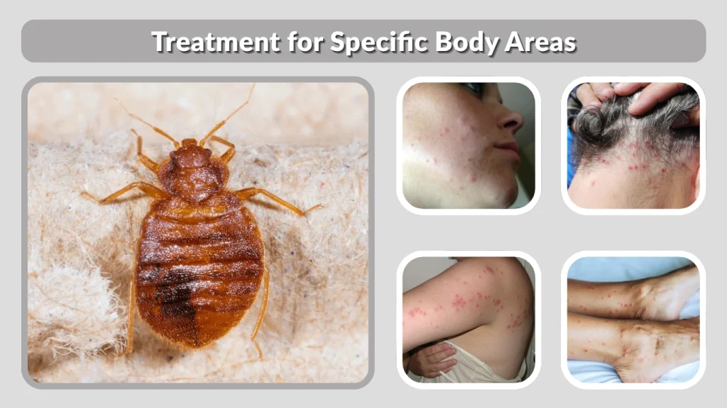 Treatment for Specific Body Areas