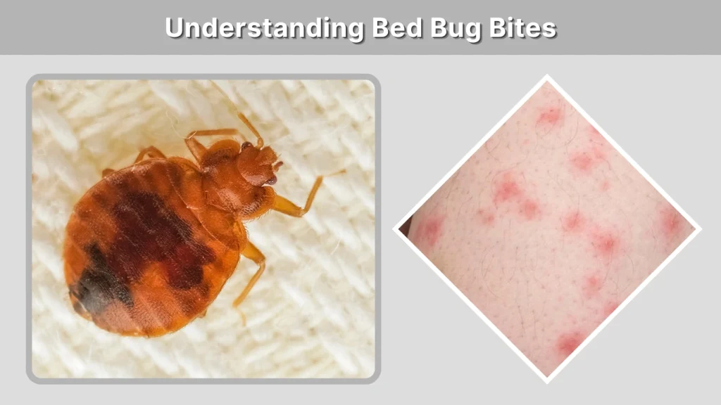 Understanding Bed Bug Bites