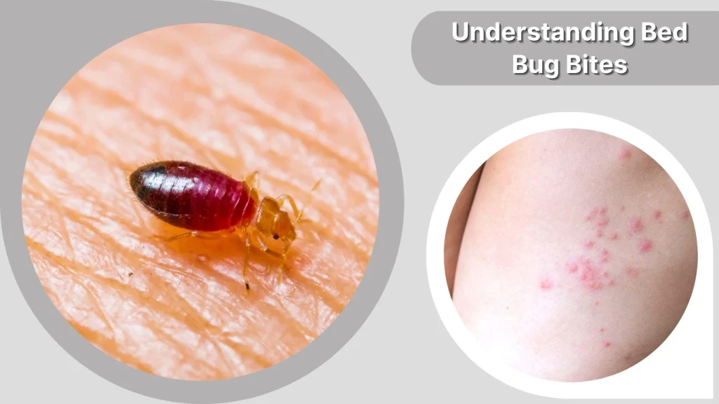Understanding Bed Bug Bites