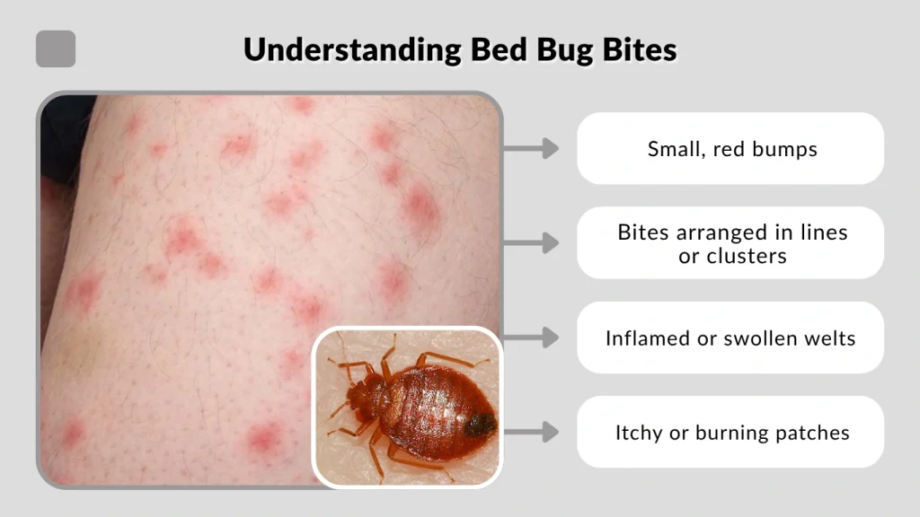 Understanding Bed Bug Bites
