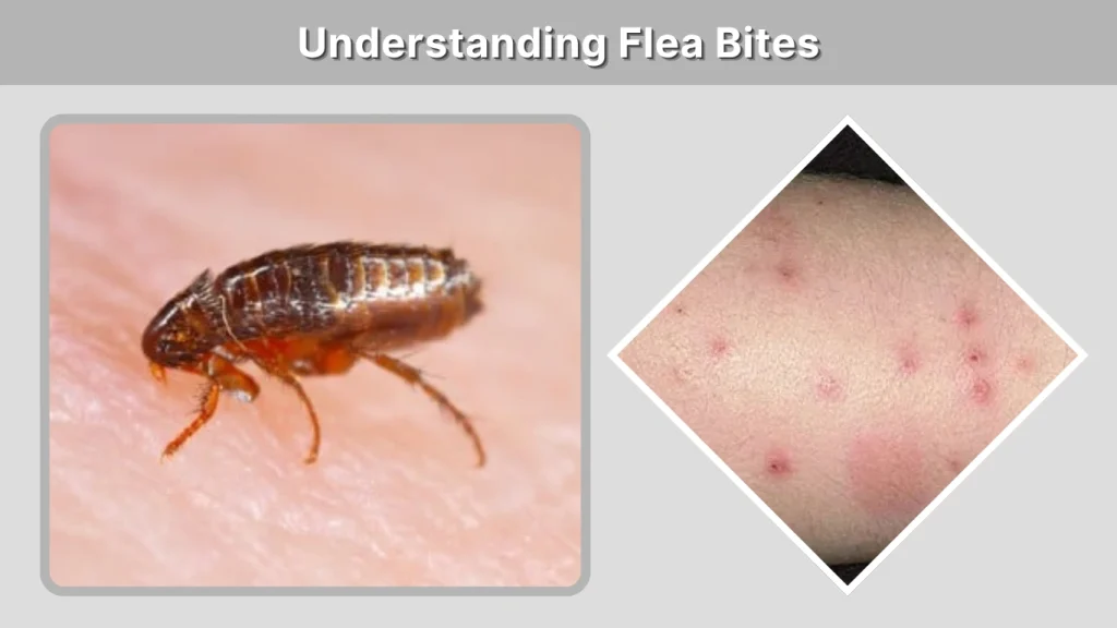 Understanding Flea Bites