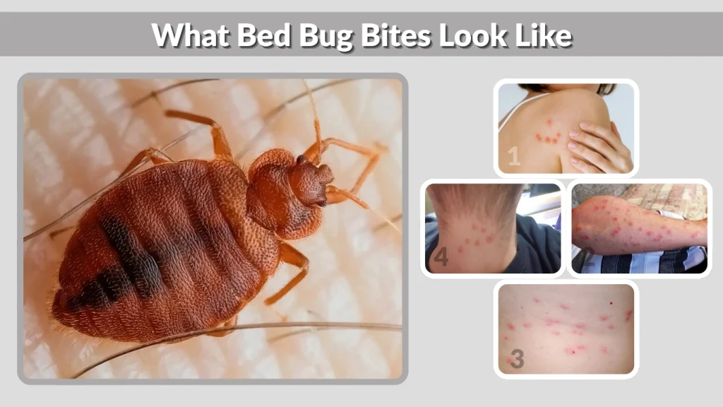 What Bed Bug Bites Look Like