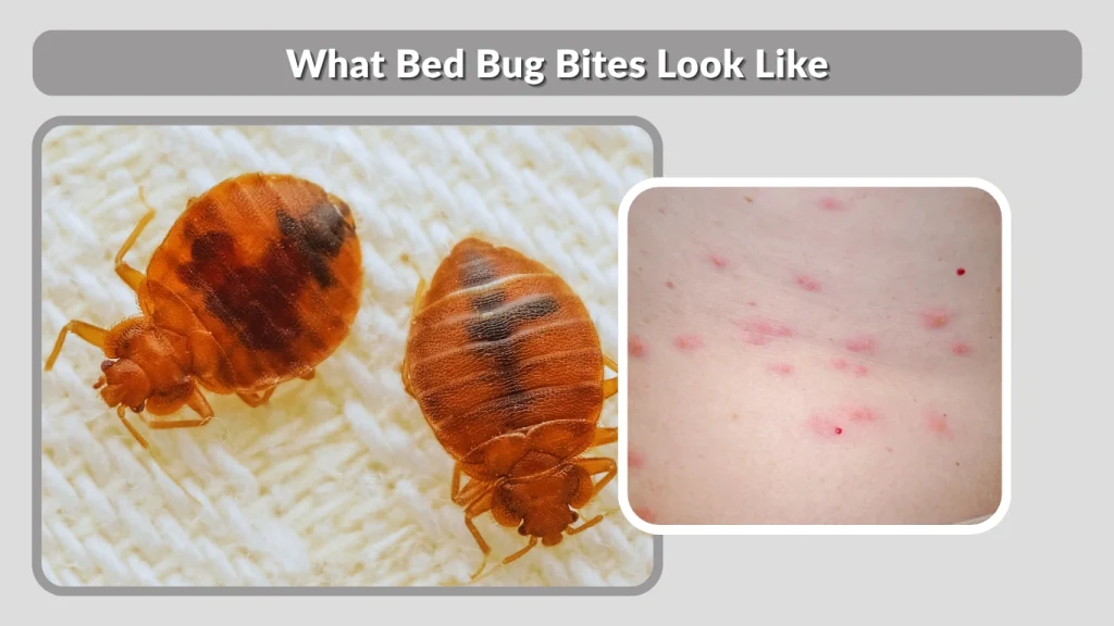 What Bed Bug Bites Look Like