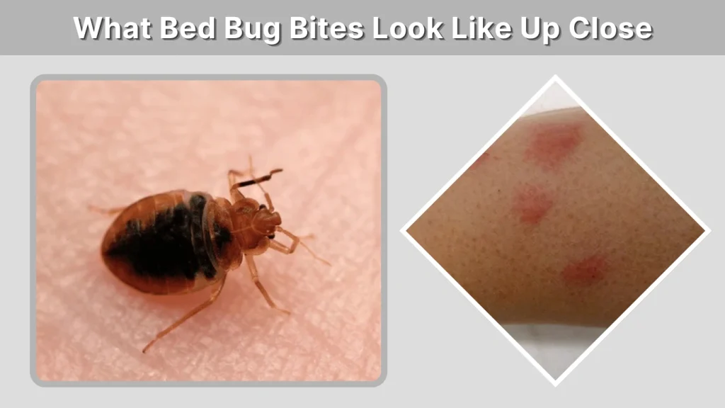 What Bed Bug Bites Look Like Up Close