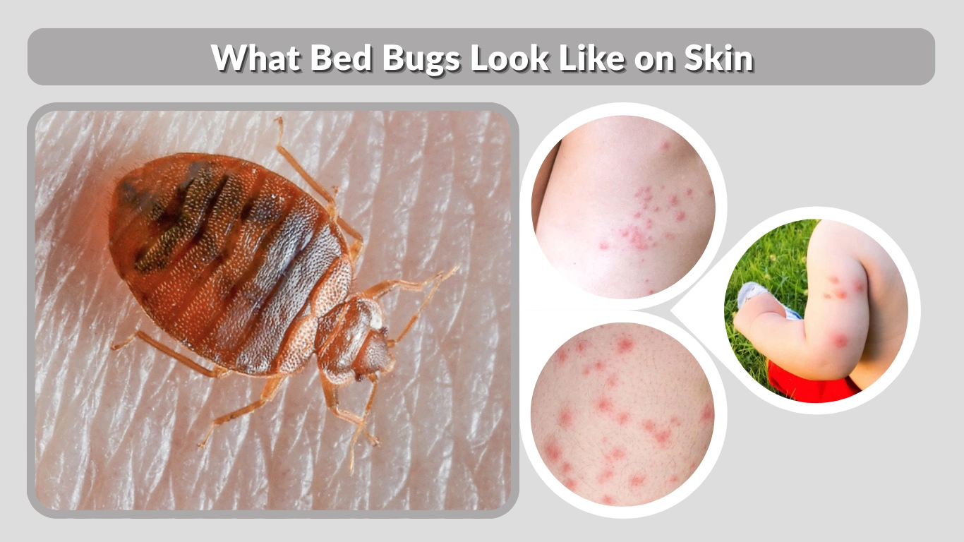 What Bed Bugs Look Like on Skin