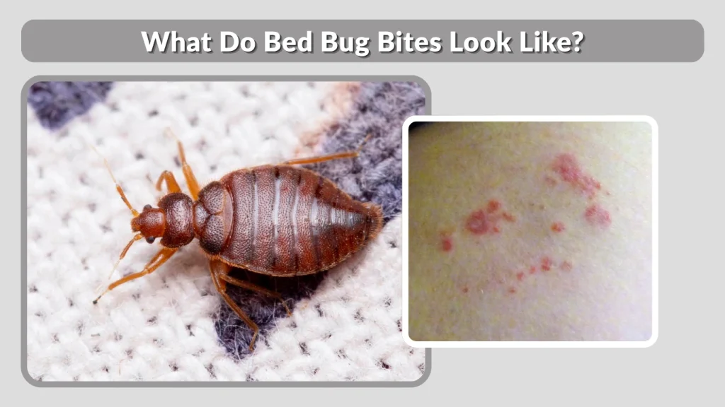 What Do Bed Bug Bites Look Like