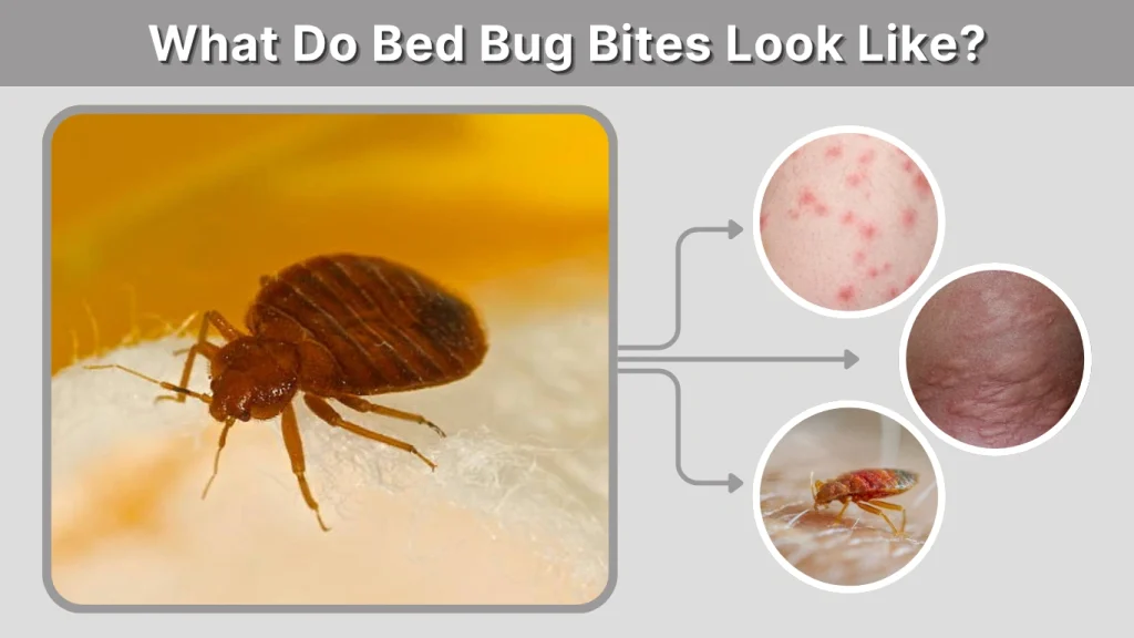 What Do Bed Bug Bites Look Like