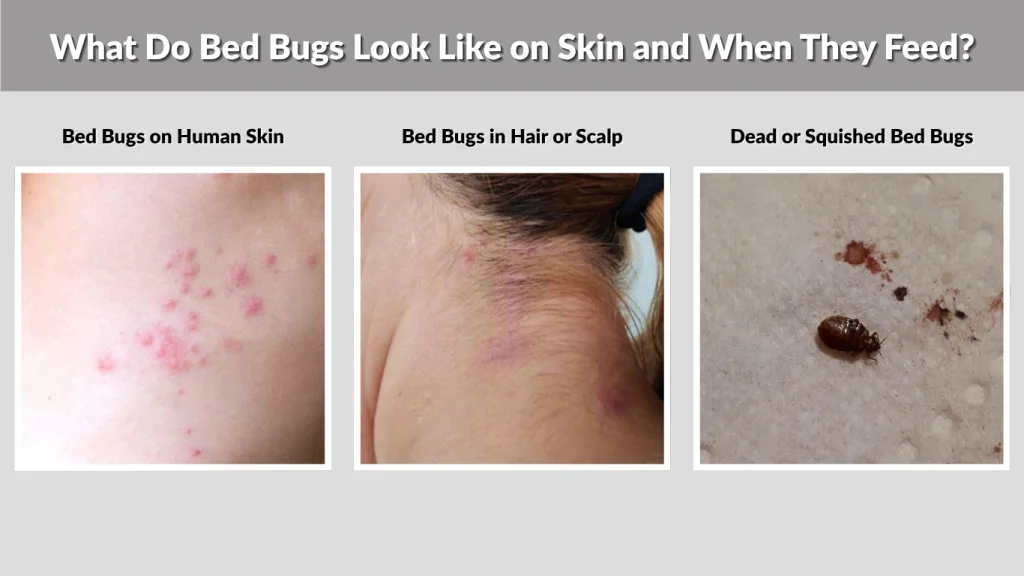 What Do Bed Bugs Look Like on Skin and When They Feed