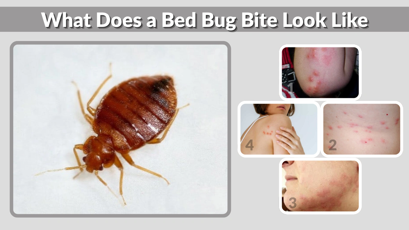 What Does a Bed Bug Bite Look Like Identification, Stages, and Treatment