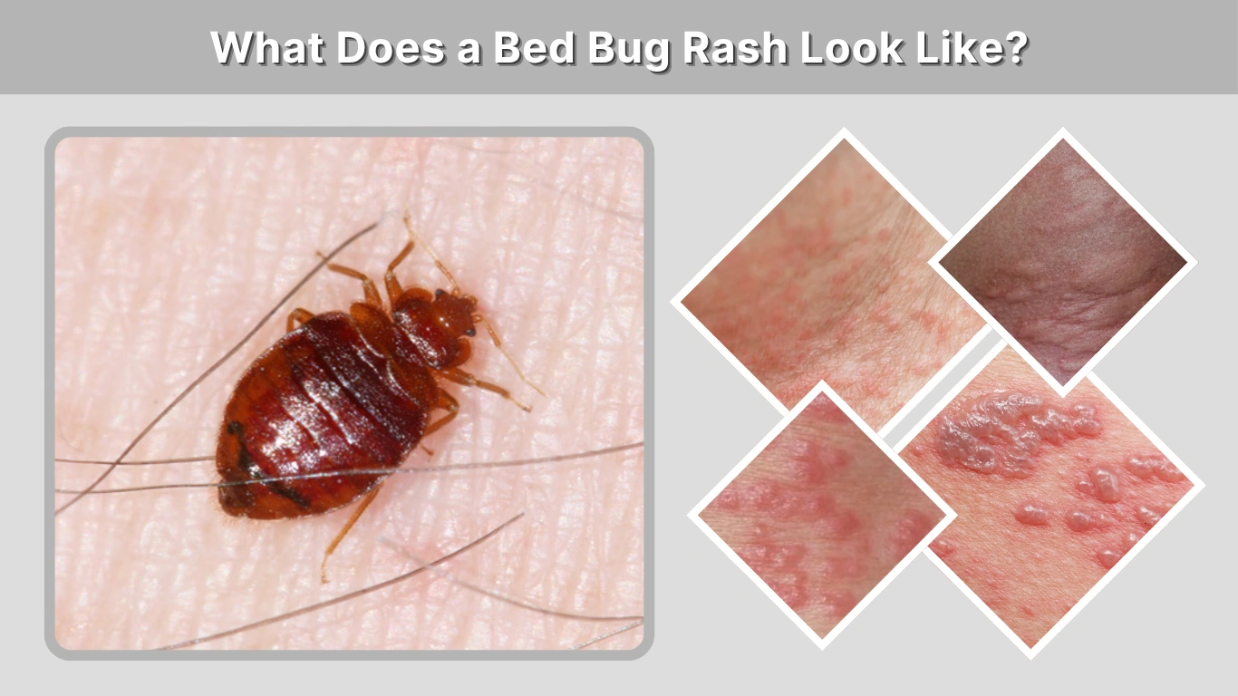 What Does a Bed Bug Rash Look Like Complete Identification Guide