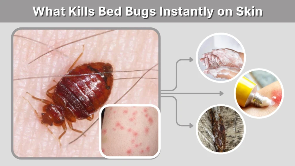 What Kills Bed Bugs Instantly on Skin