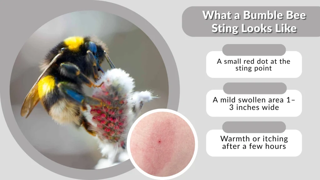 What a Bumble Bee Sting Looks Like