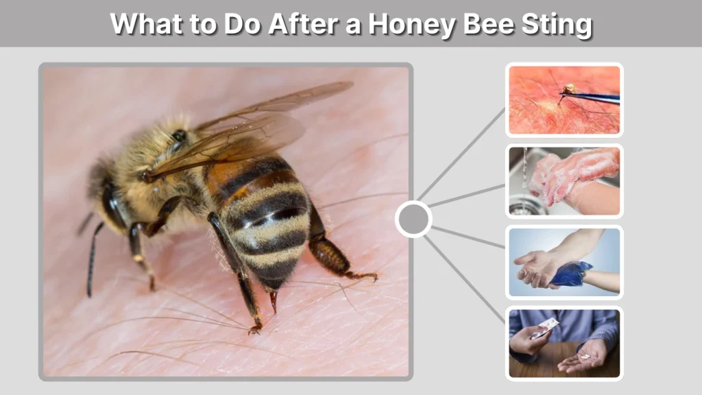 What to Do After a Honey Bee Sting