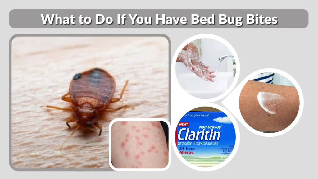 What to Do If You Have Bed Bug Bites