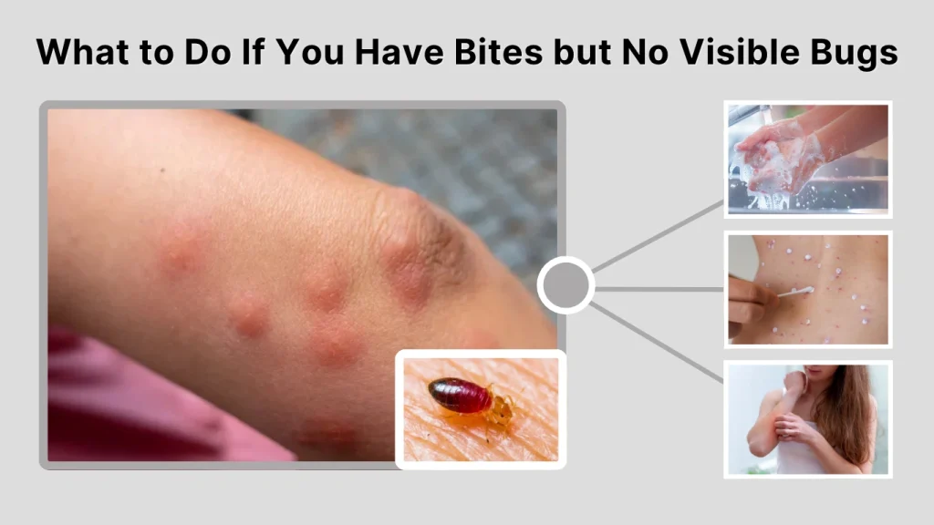 What to Do If You Have Bites but No Visible Bugs