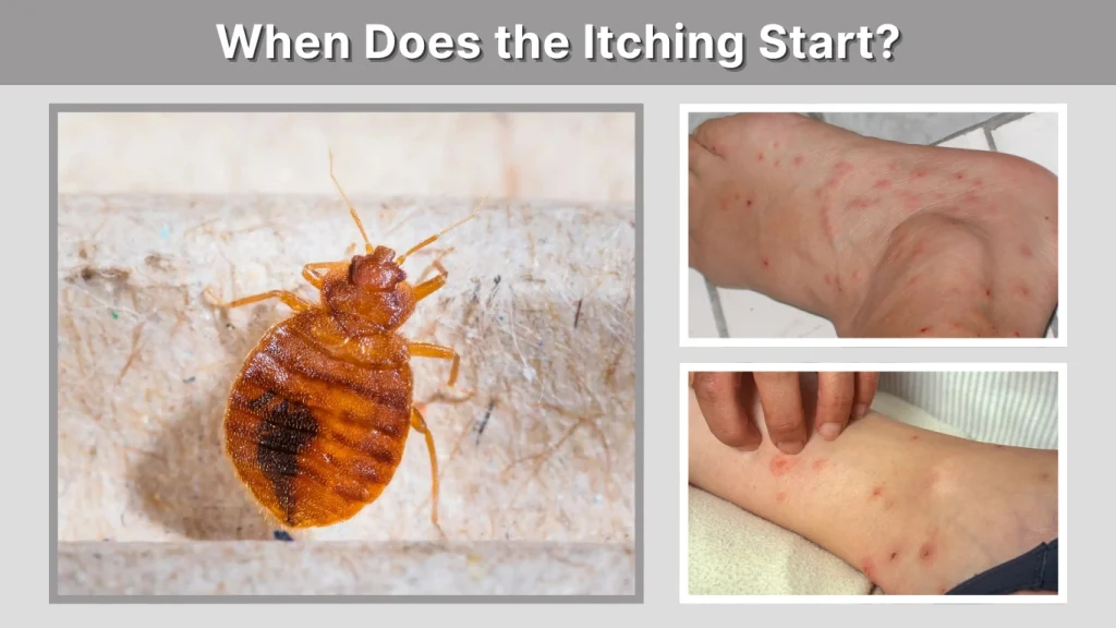 When Does the Itching Start