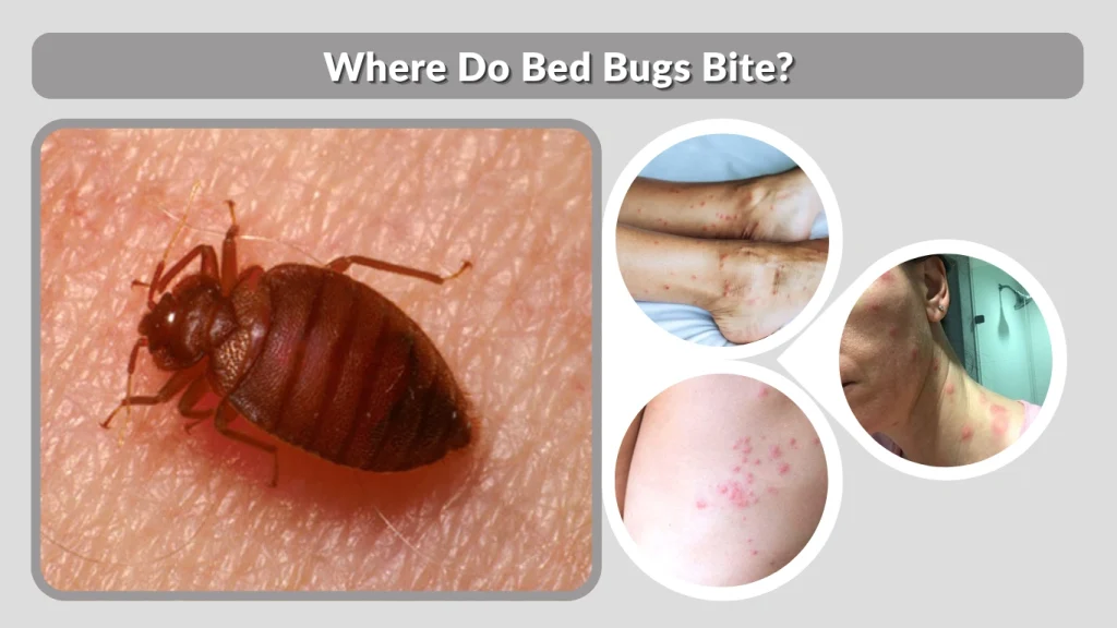 Where Do Bed Bugs Bite