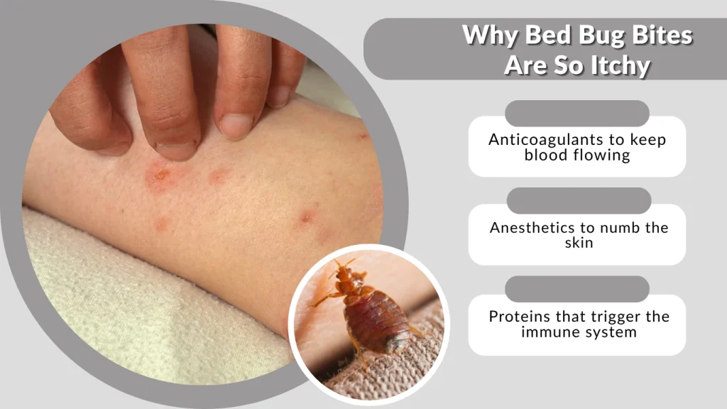 Why Bed Bug Bites Are So Itchy