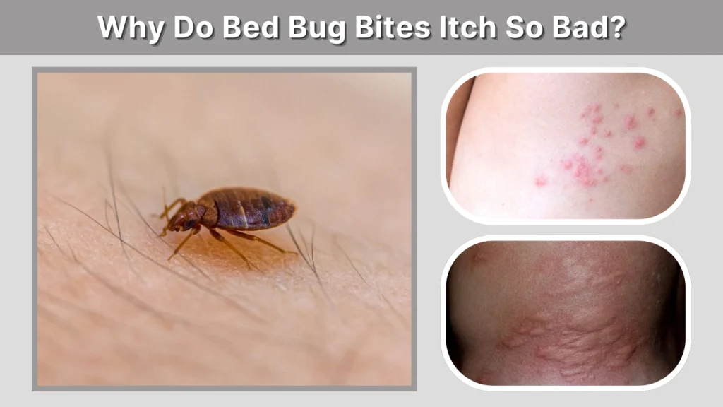 Why Do Bed Bug Bites Itch So Bad