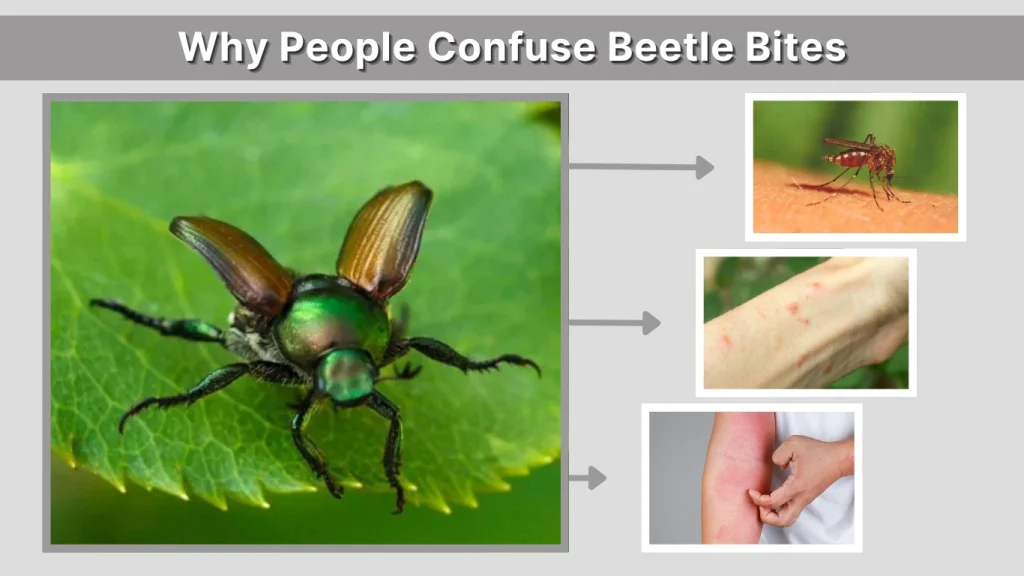Why People Confuse Beetle Bites