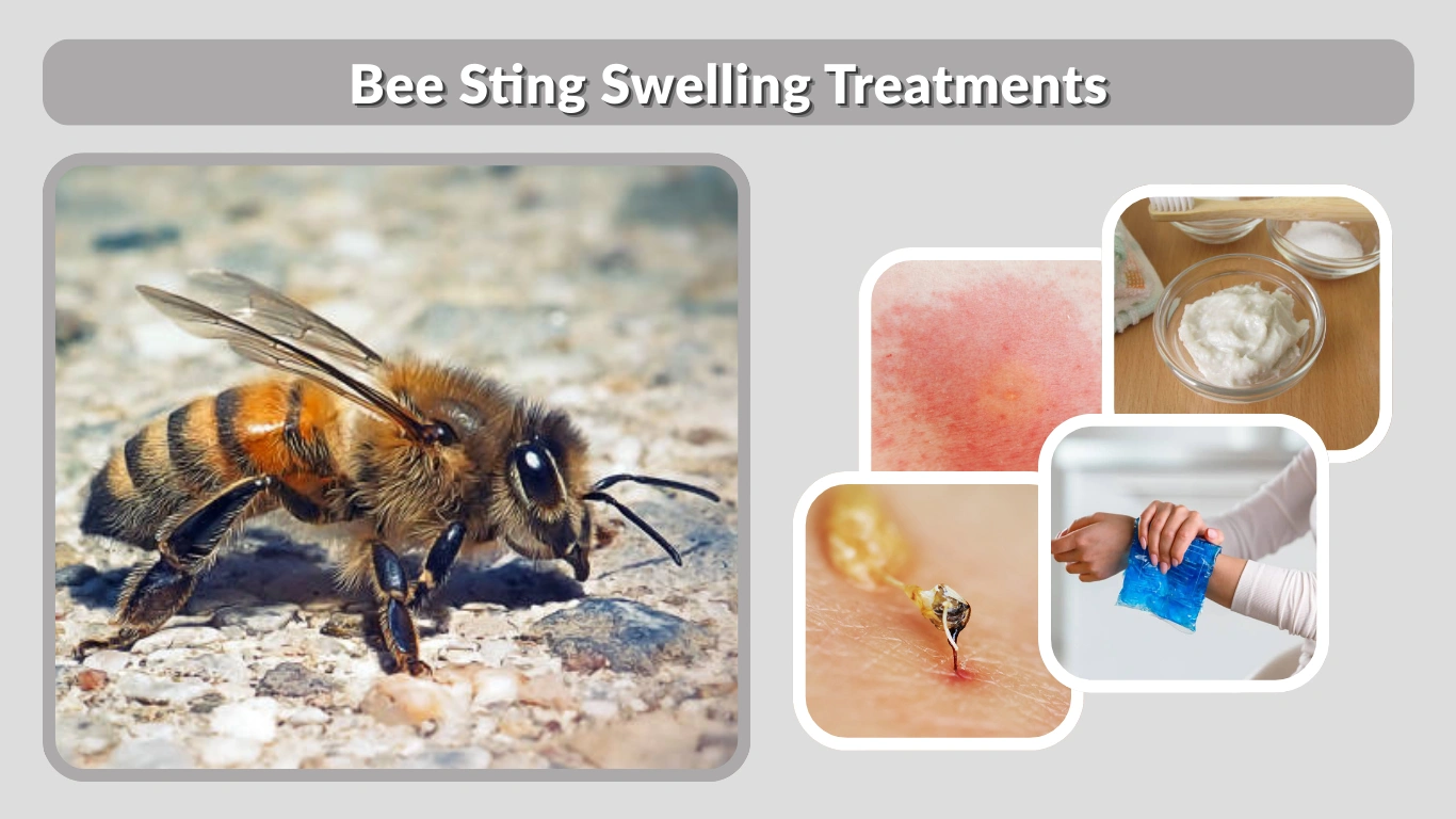 Bee Sting Swelling Treatments Fast Relief & Home Remedies