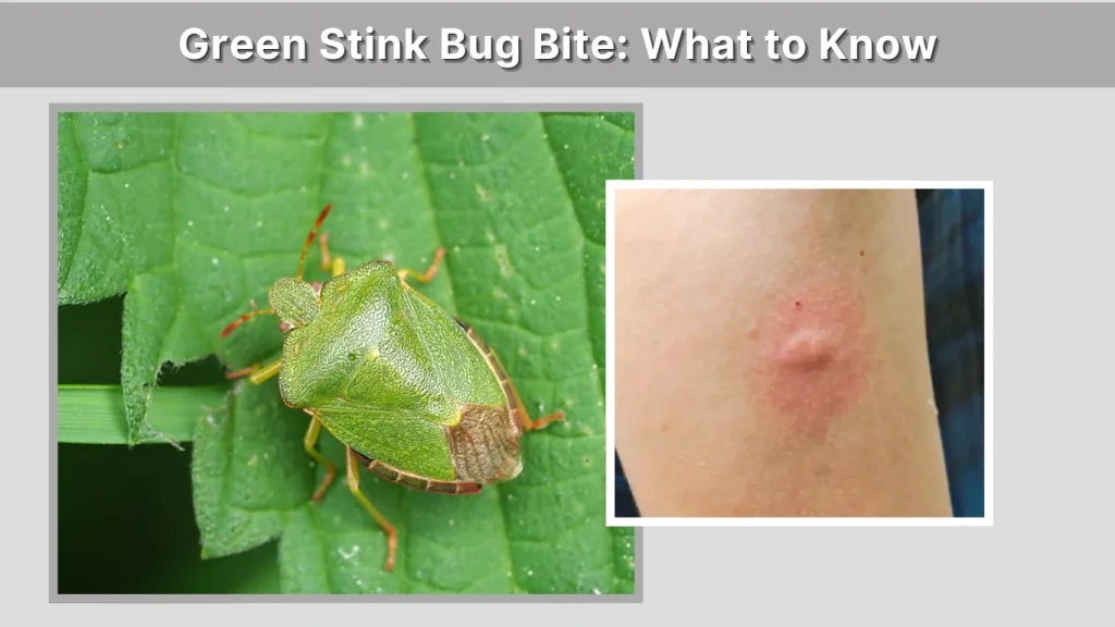 Green Stink Bug Bite What to Know