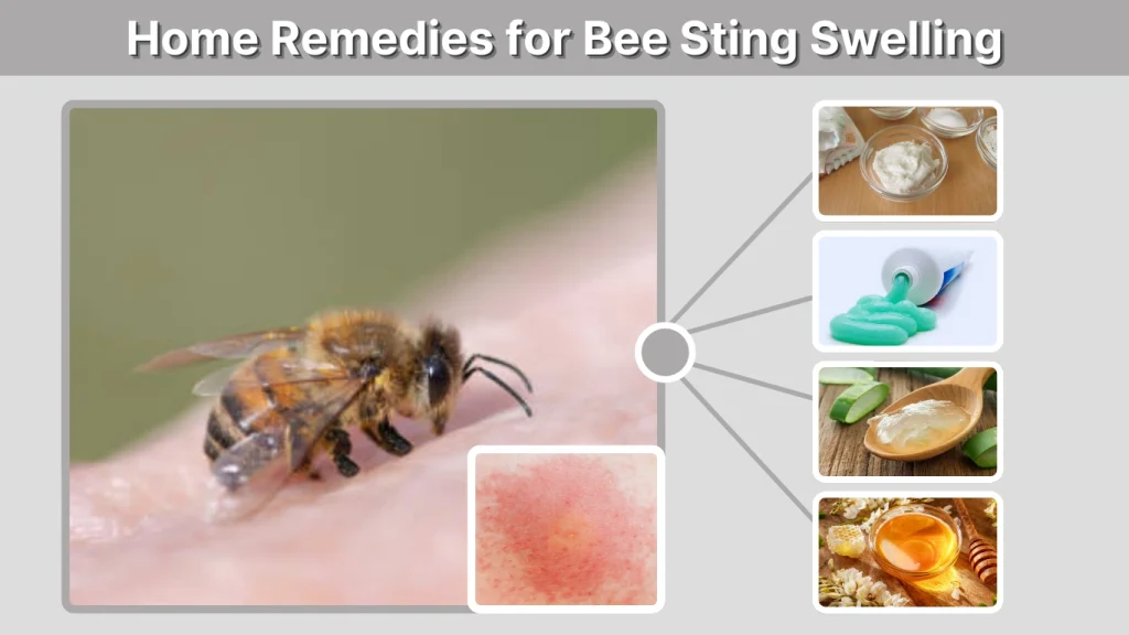 Home Remedies for Bee Sting Swelling
