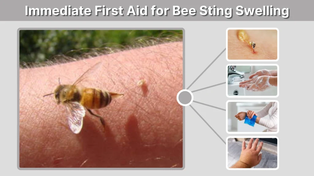 Immediate First Aid for Bee Sting Swelling