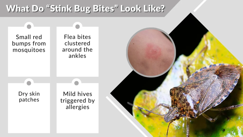 What Do “Stink Bug Bites” Look Like