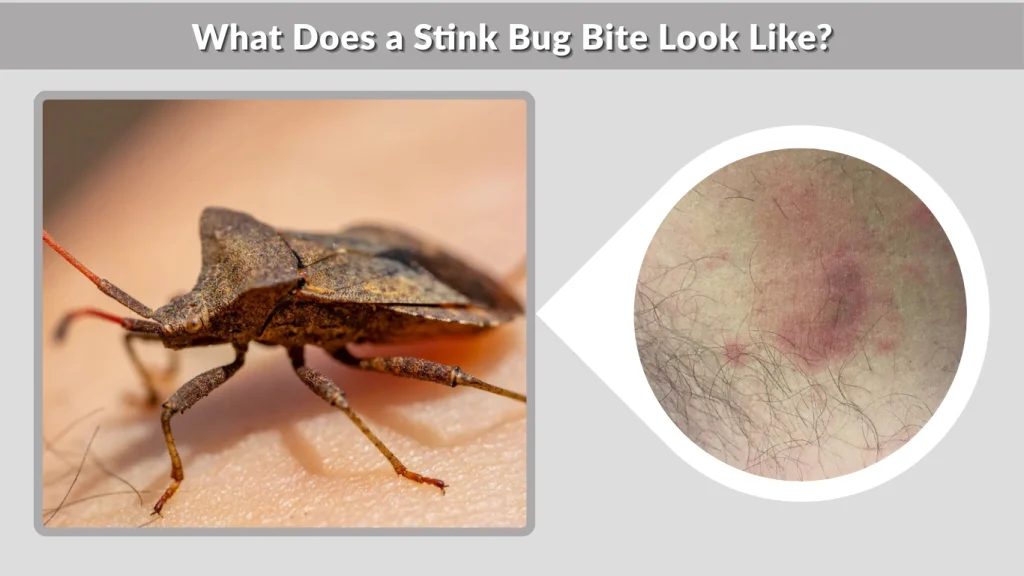 What Does a Stink Bug Bite Look Like