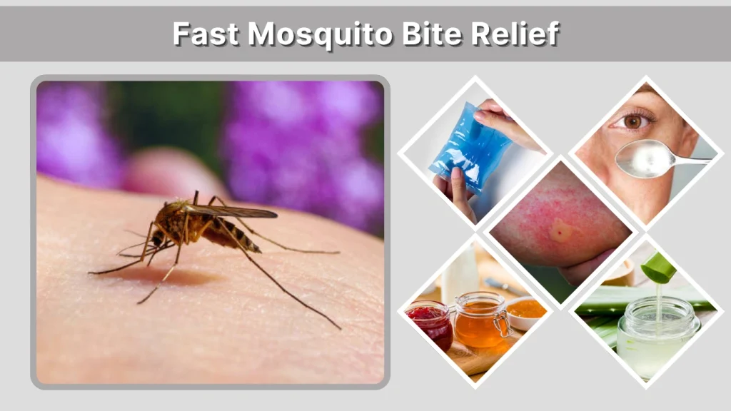 Fast Mosquito Bite Relief
