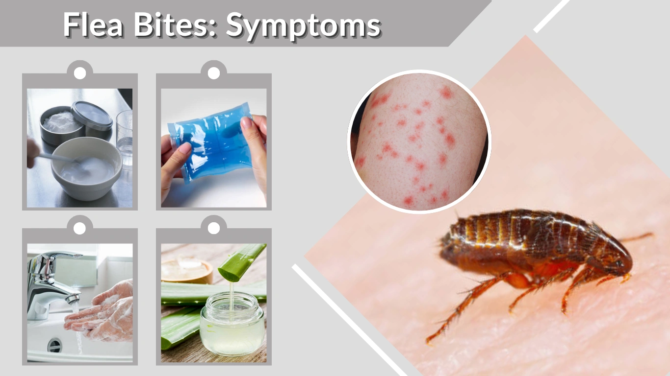 Flea Bites Symptoms, Treatment, and How to Get Relief Fast