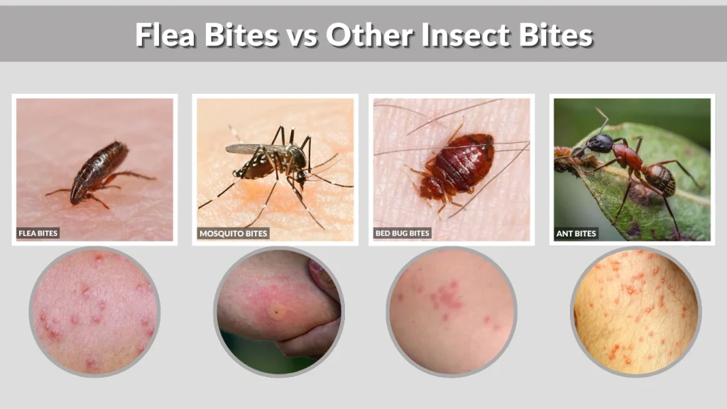 Flea Bites vs Other Insect Bites