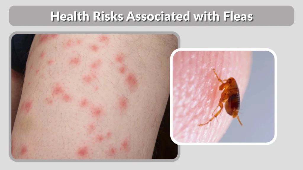 Health Risks Associated with Fleas