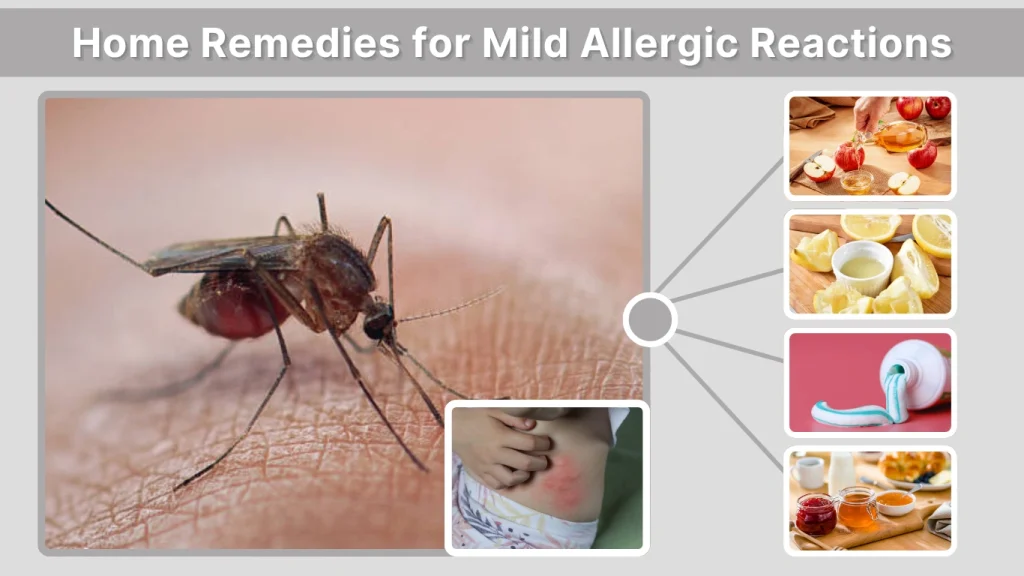 Home Remedies for Mild Allergic Reactions