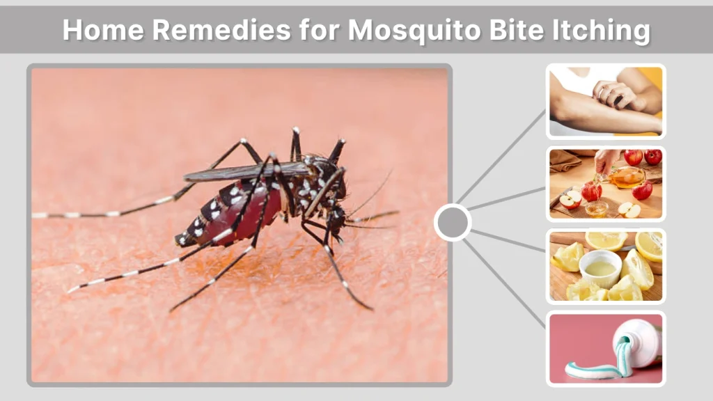 Home Remedies for Mosquito Bite Itching