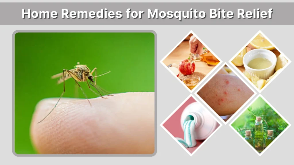 Home Remedies for Mosquito Bite Relief